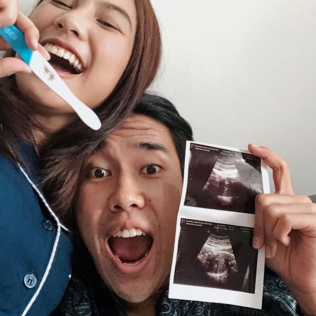 Umumkan Kehamilan Pertama, 10 Potret Mesra Shabrina dan Ryuji Utomo