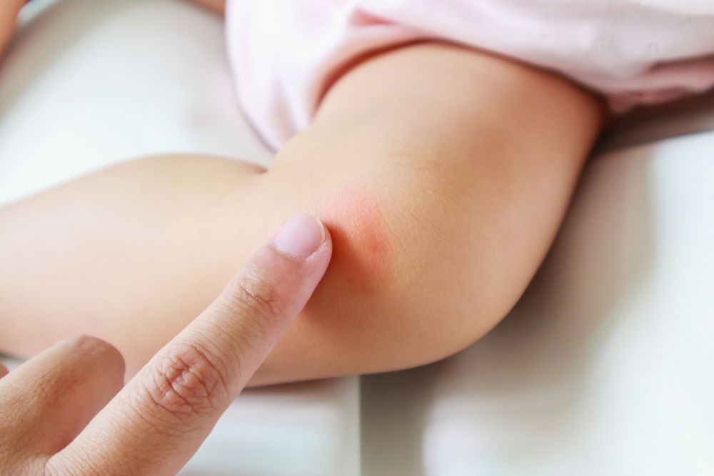 Kenali 10 Gejala Meningitis, Penyakit Peradangan pada Otak