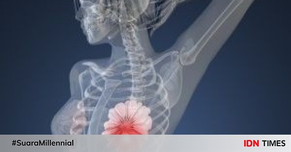 Ketahui 7 Fakta Fibroadenoma Tumor Jinak Di Payudara