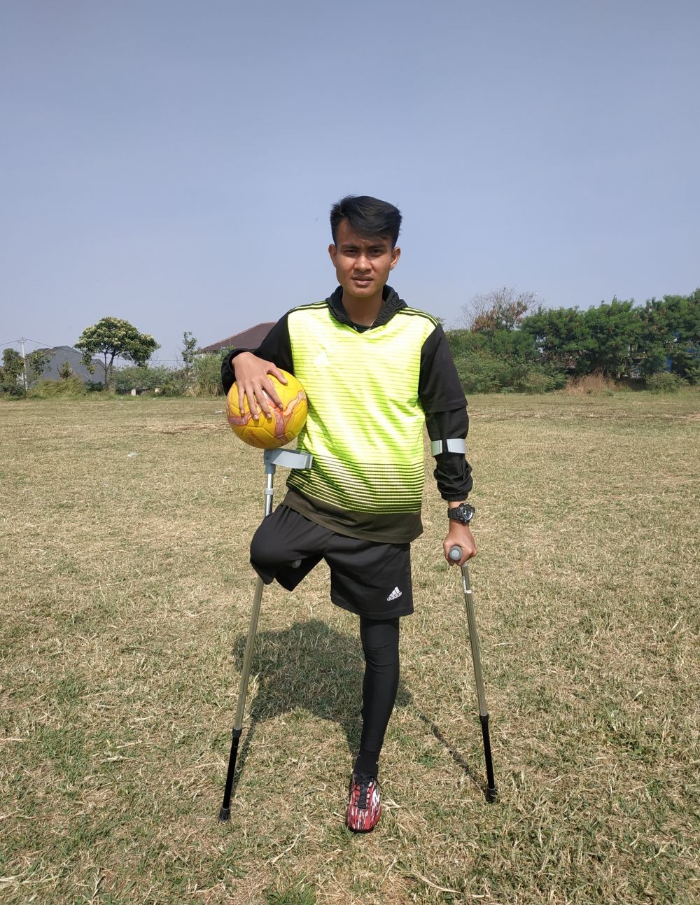 Tanpa Kaki, Eks Pemain Persib Ini Siap Bermain di Piala Dunia Amputee