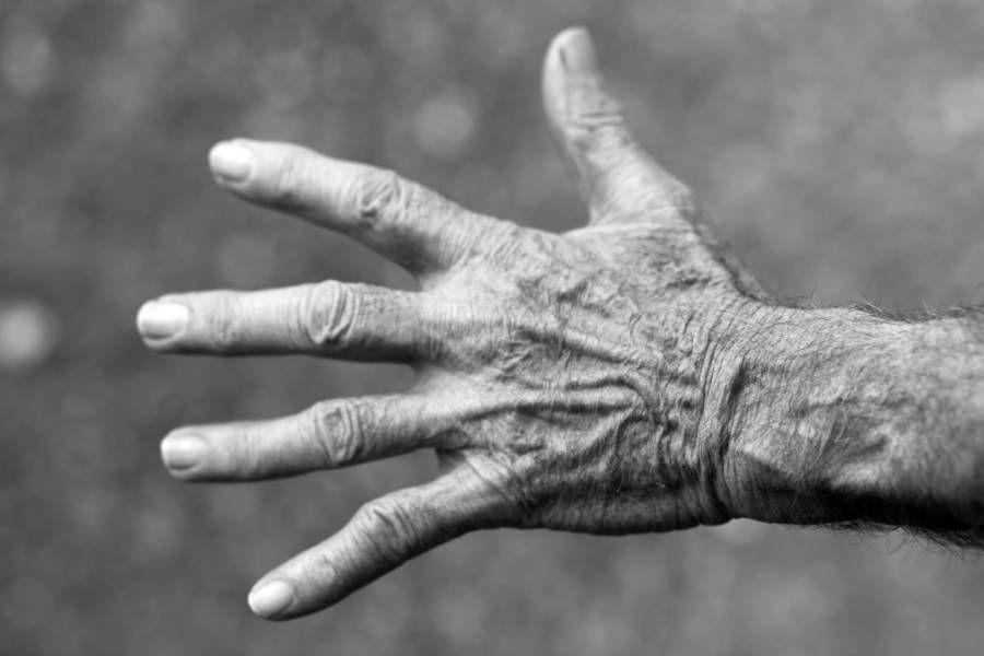 7 Fakta Sindrom Tangan Alien, Bikin Tanganmu Gerak Sendiri