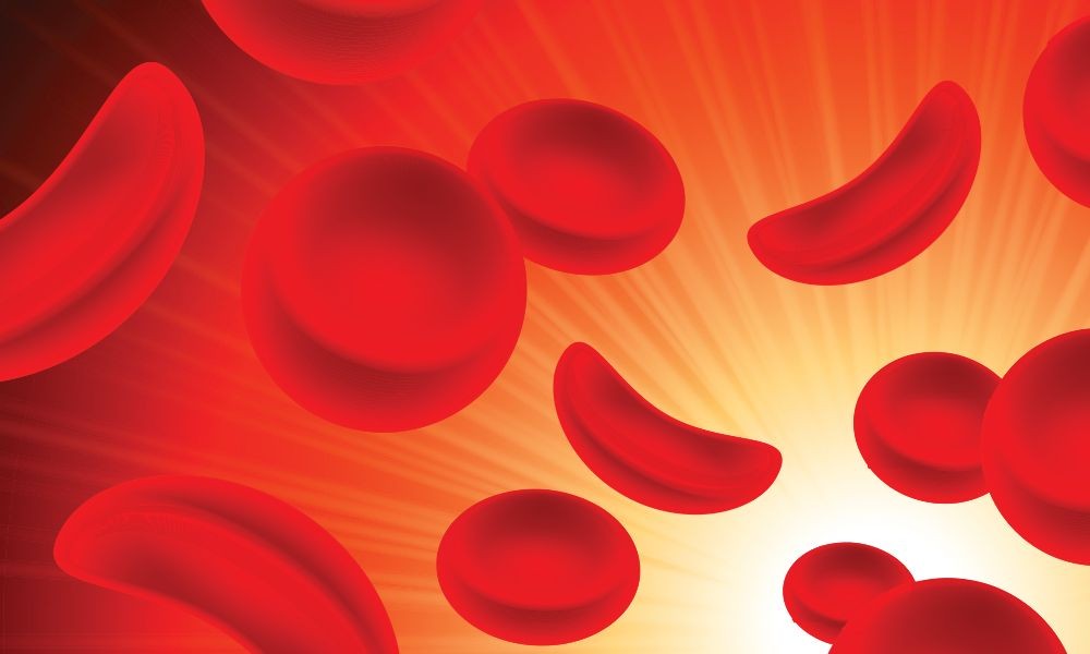 Mengenal Penyakit Sel Sabit Bisa Mengubah Bentuk Sel Darah Merahmu