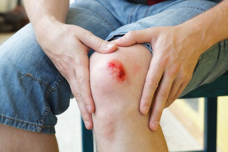 7 Penyebab Rematik yang Paling Umum, Anak Muda Juga Berisiko Mengalami