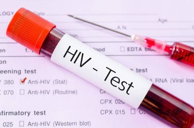Kalian Mengidap HIV/AIDS? Jangan Malu untuk Melapor dan Berobat