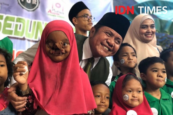 Senyum Bersama Penderita Bibir Sumbing, Herman Deru: Saya mau Nangis