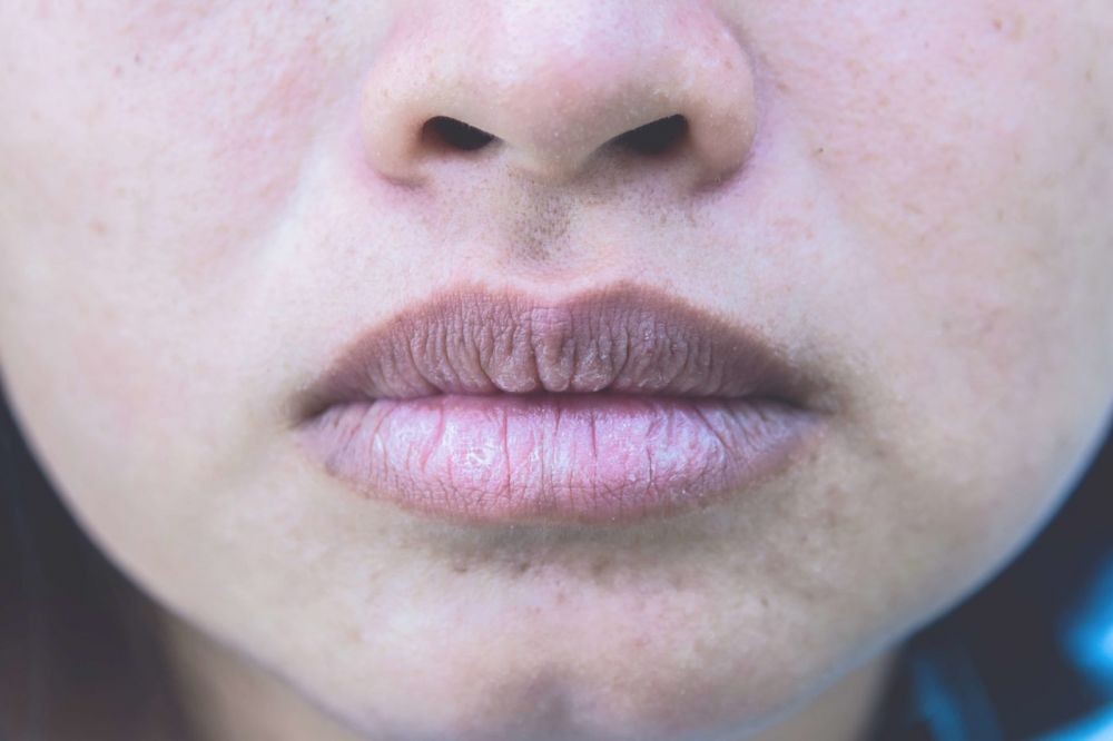 5 Warna Bibir ini Bisa Jadi Indikator Kesehatan Tubuh