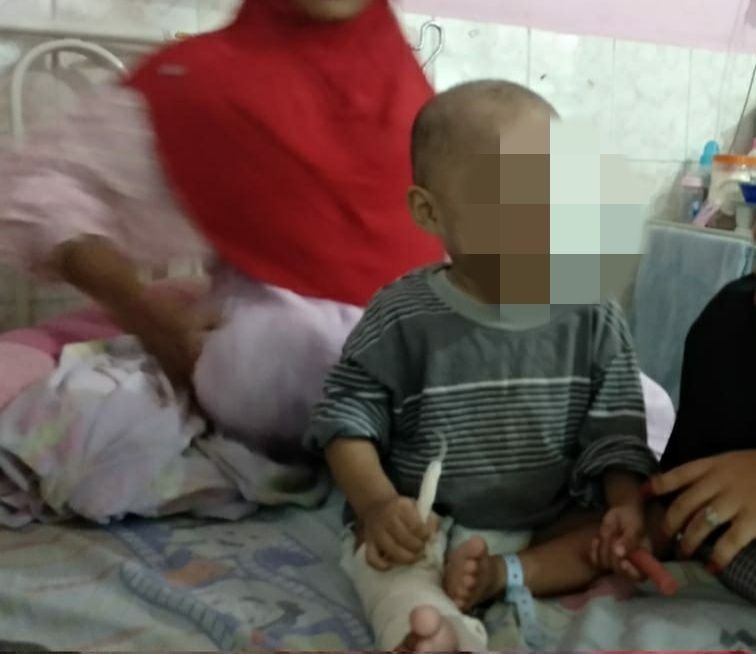 Bocah Tiga Tahun di Samarinda Disiksa Ibu Kandung hingga Patah Kaki