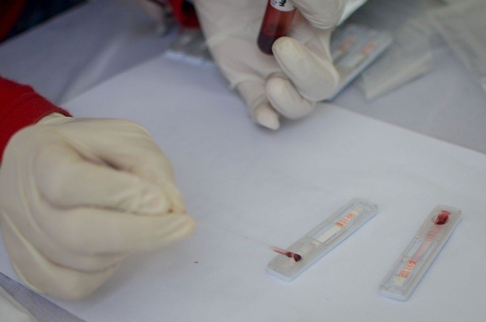 Dinkes: 1.600 Pasien HIV Jalani Perawatan di Tangsel 