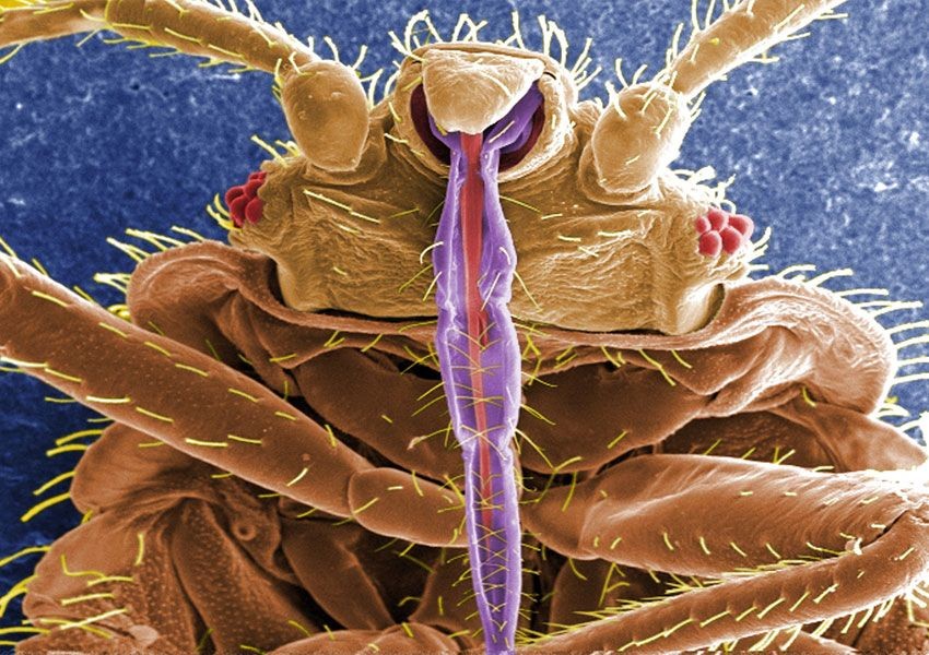 Monster Mikroskopis yang Merugikan Manusia