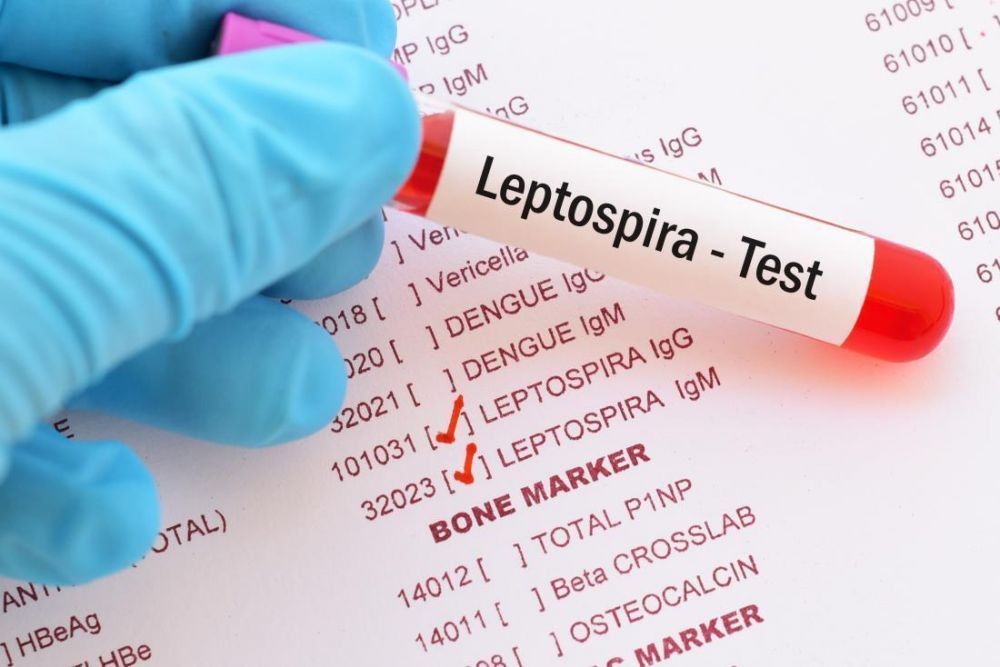 Sepanjang Januari-Maret, 4 Warga Sleman Meninggal karena Leptospirosis