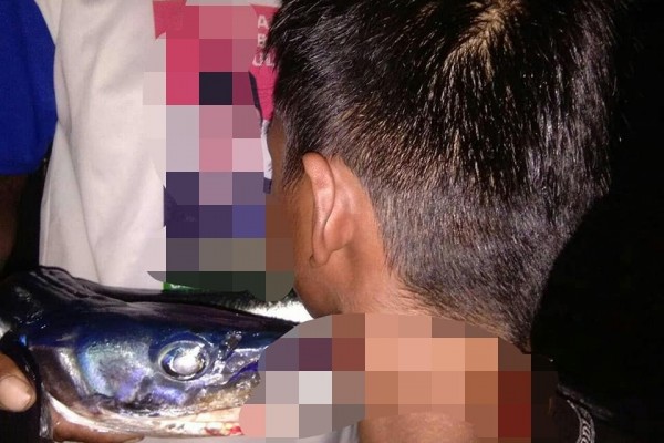 RS Wahidin Selamatkan Remaja yang Lehernya Tertancap Ikan Sori