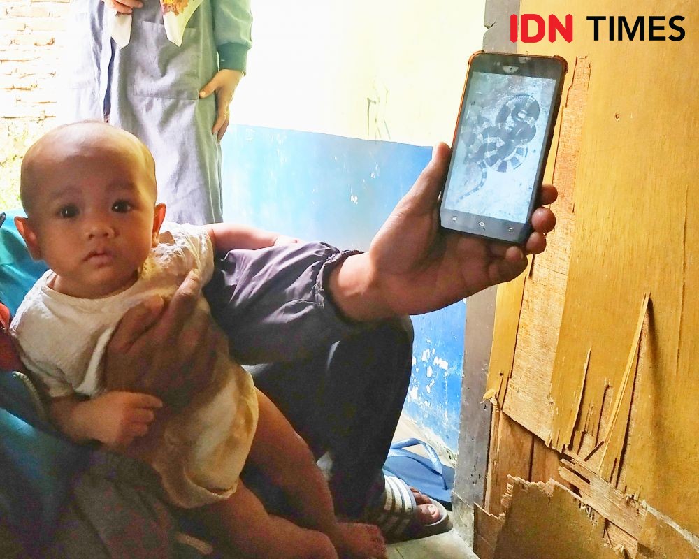 Seorang Anak Kecil di Bandung Meninggal Digigit Ular Peliharaannya