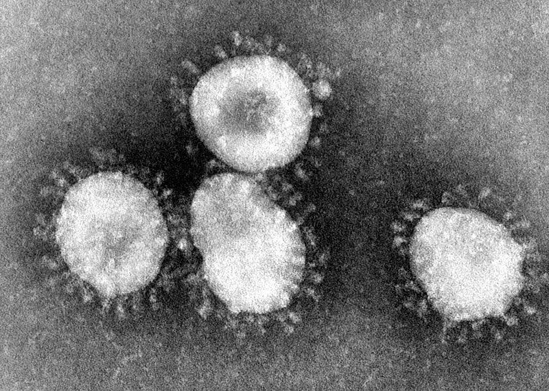 Tangkal Virus Corona, 10 RS di Jawa Tengah Siapkan Ruang Isolasi