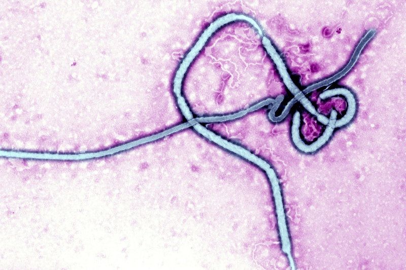 12 Virus Paling Berbahaya di Muka Bumi, Lebih Mematikan Dari COVID-19 