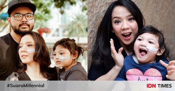 10 momen namira monda dan aurora, berjuang hadapi craniosynostosis