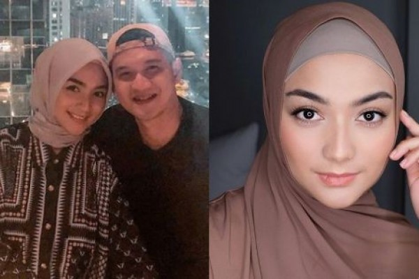 Hamil Muda, 10 Pesona Terbaru Citra Kirana yang Makin Paripurna
