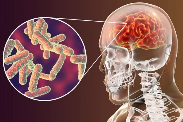 Penyebab Meninggalnya Glenn Fredly, Ini 8 Cara Mencegah Meningitis