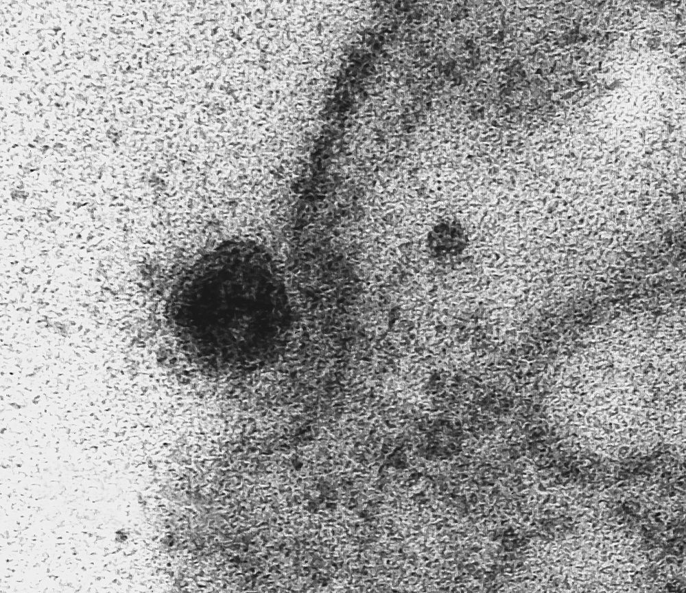 Ini Penampakan Asli Virus Corona Saat Masuk ke Sel Tubuh Manusia