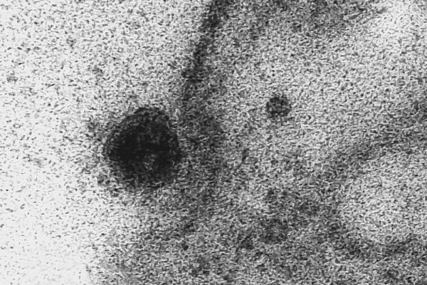 Ini Penampakan Asli Virus Corona Saat Masuk ke Sel Tubuh Manusia