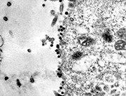 Ini Penampakan Asli Virus Corona Saat Masuk ke Sel Tubuh Manusia