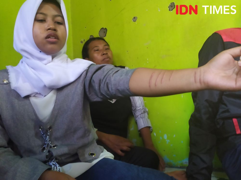 Nestapa PRT di Semarang, Disiksa Bertubi-tubi Sampai Pita Suaranya Rusak