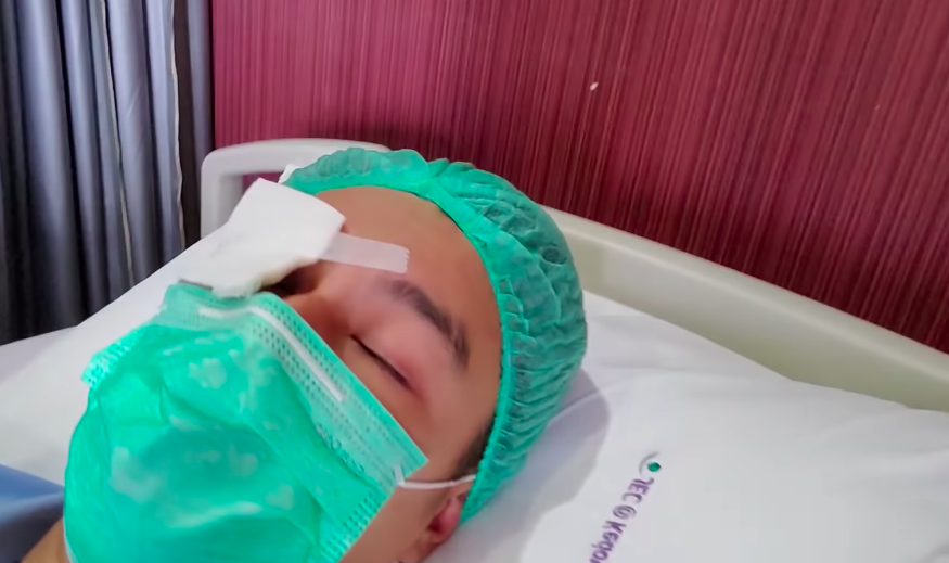 Menderita Katarak, 10 Momen Operasi Mata Baim Wong