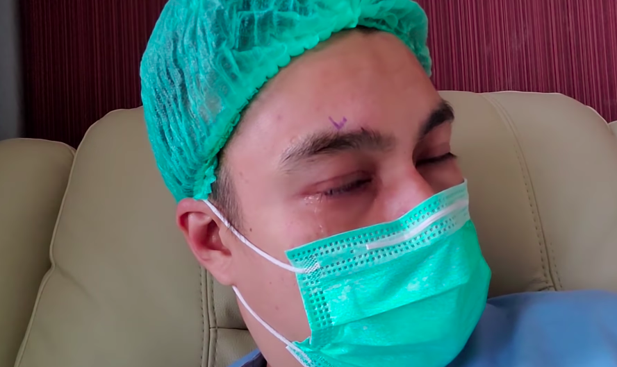Menderita Katarak, 10 Momen Operasi Mata Baim Wong