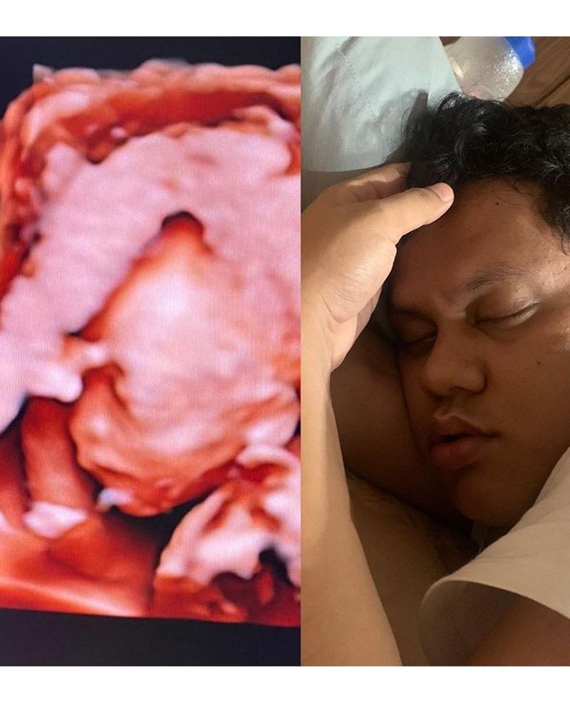 8 Potret USG Bayi Artis, Masih dalam Kandungan Gayanya sudah Lucu