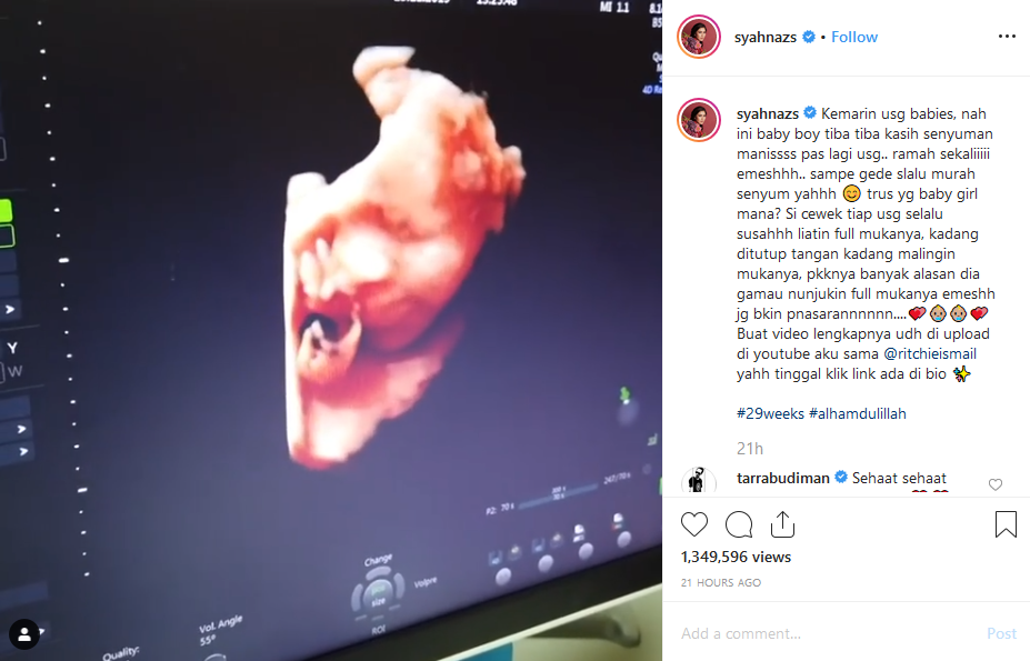 8 Potret USG Bayi Artis, Masih dalam Kandungan Gayanya sudah Lucu