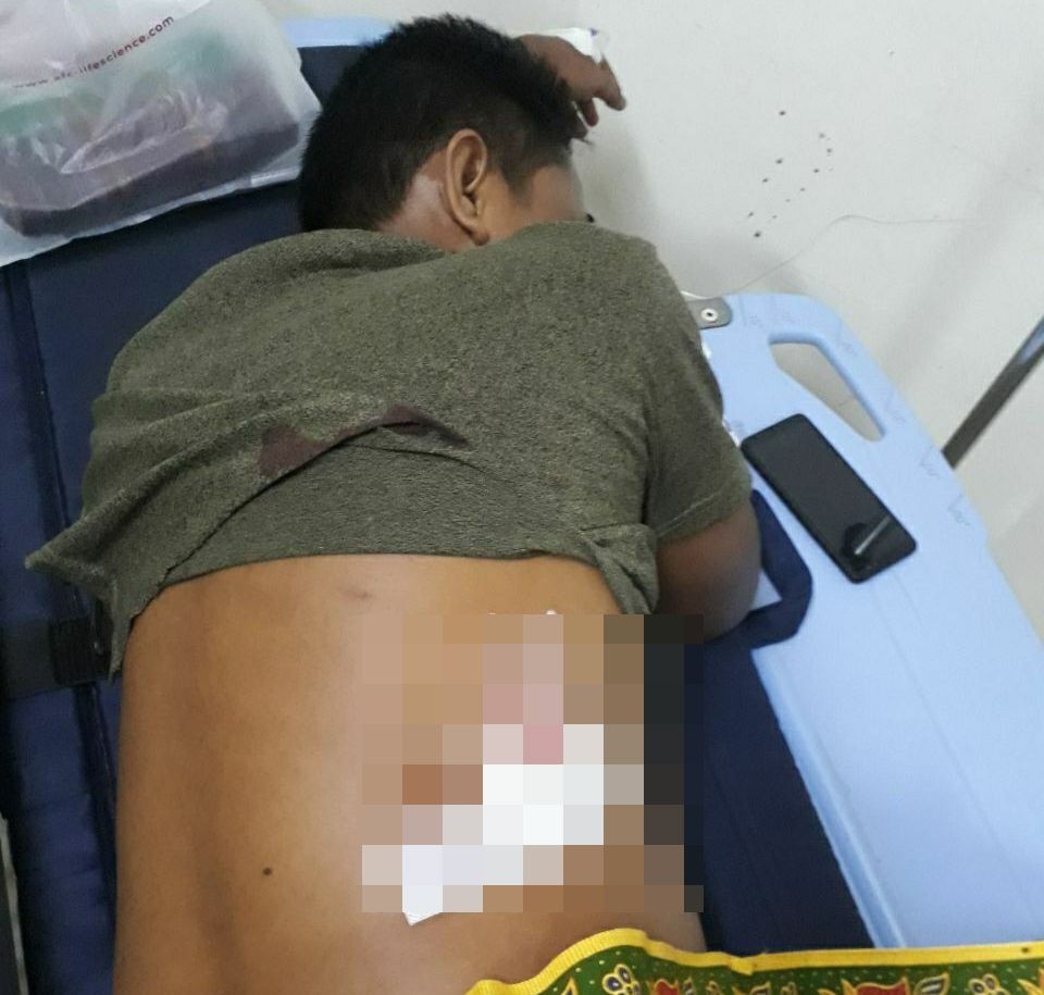 Pulang Sendiri Tengah Malam, Anggota Polisi di Makassar Dipanah OTK 