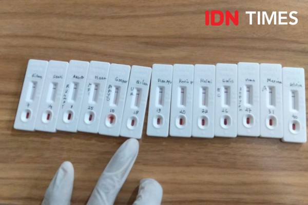Cepat Menular, Dinkes Semarang Kirim Sampel 20 Pasien COVID-19 ke UGM