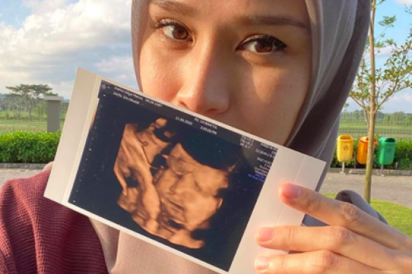 Lahirkan Anak Kelima, 10 Potret Perjuangan Zaskia Mecca Sejak Hamil