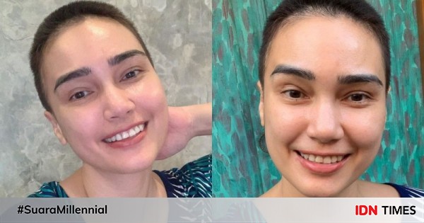 10 potret feby febiola yang mengaku sudah enam kali kemoterapi, tegar!