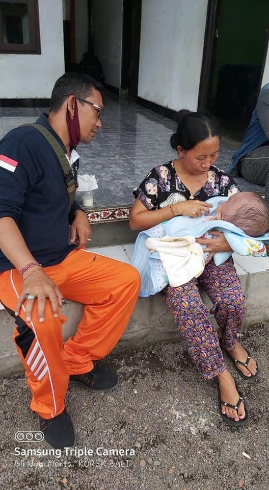 Kisah Komang Sarini di Bali, Lahirkan Bayi dengan 3 Kelainan