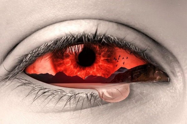 6 Fakta Medis Konjungtivitis, Gak Kalah Ngeselin dari Bintitan