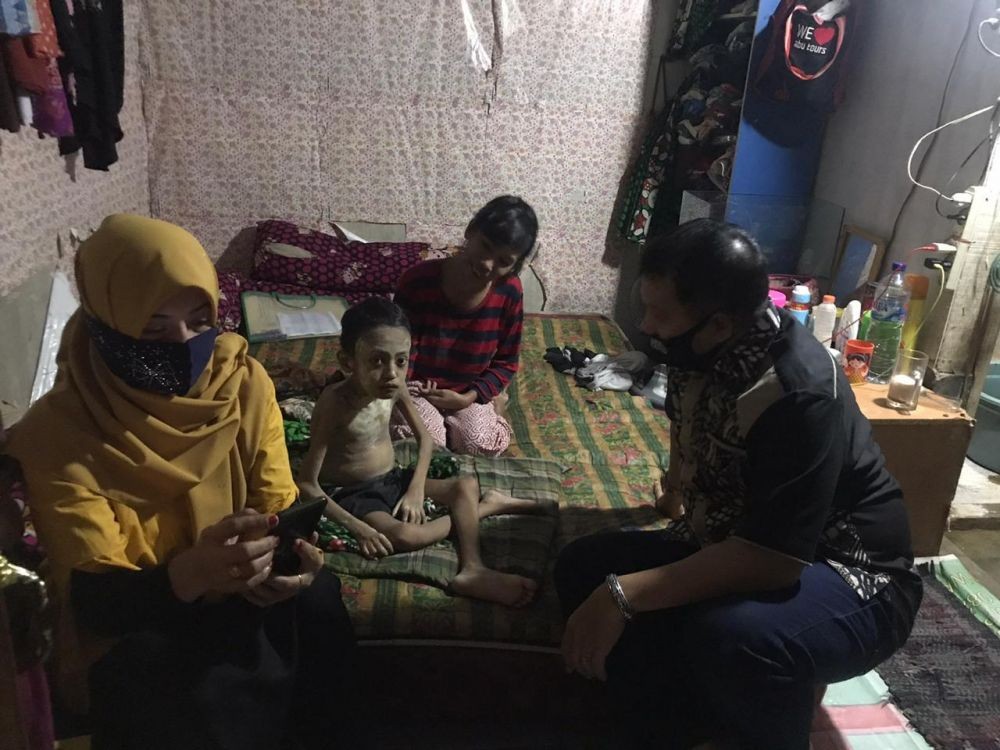 Anak Penderita Polio dan Kekurangan Gizi di Makassar Dibantu Pemprov