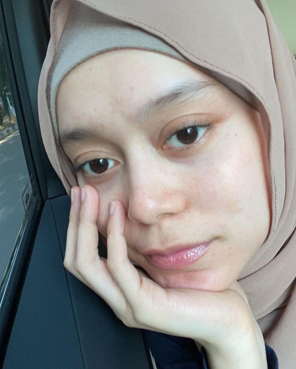 10 Potret Lesty Kejora Tanpa Makeup, Gak Banyak yang Tahu!