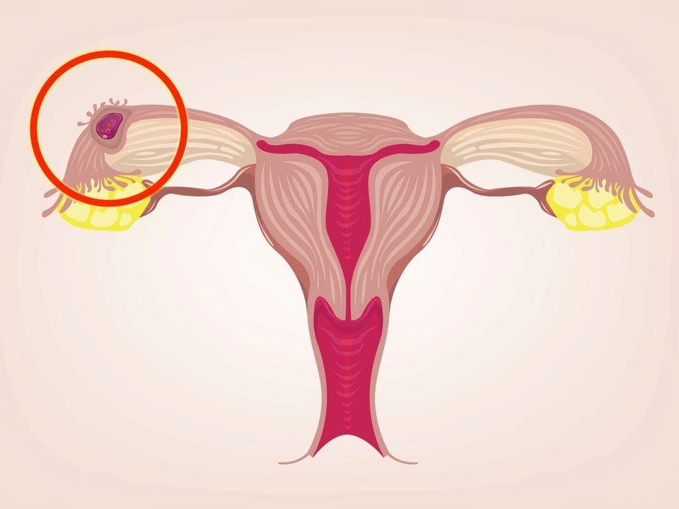 Dear Ladies, Ini 7 Bahaya Douching Vagina yang Harus Kamu Tahu