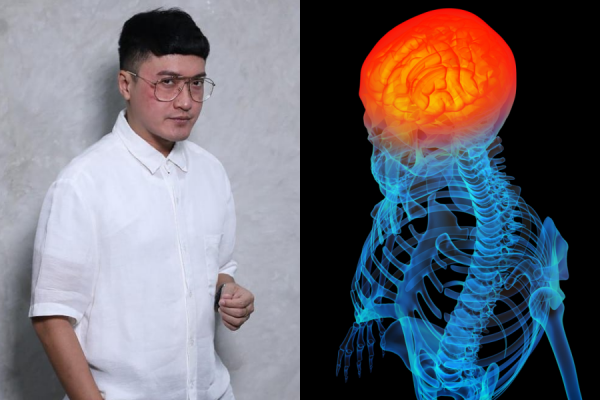 Barli Asmara Meninggal karena Radang Otak, Ini Fakta dan Gejalanya