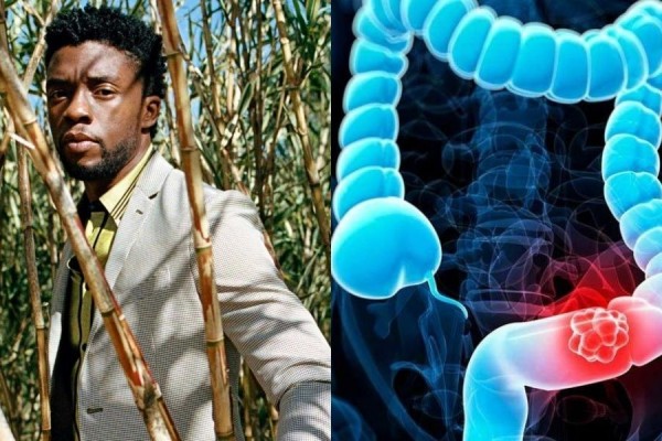 Mengenal Kanker Usus Besar, Penyakit yang Diderita Chadwick Boseman