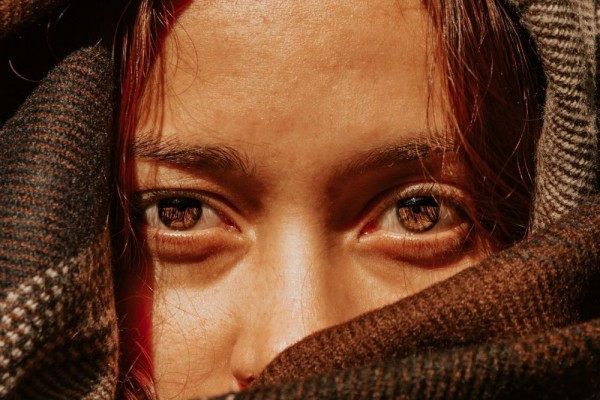 6 Penyebab Munculnya Kantung Mata di Wajah, Bukan Cuma Kurang Tidur
