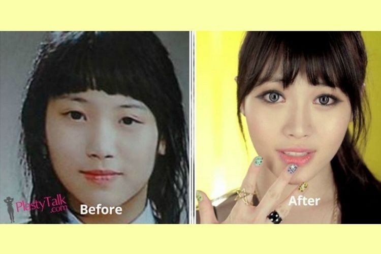 Perubahan Wajah 9 Artis Korea Sebelum dan Sesudah Oplas, Beda Banget