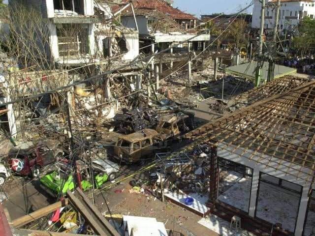 Kisah Korban Bom Bali I: Capek Saya Masuk Ruang Operasi Berkali-kali