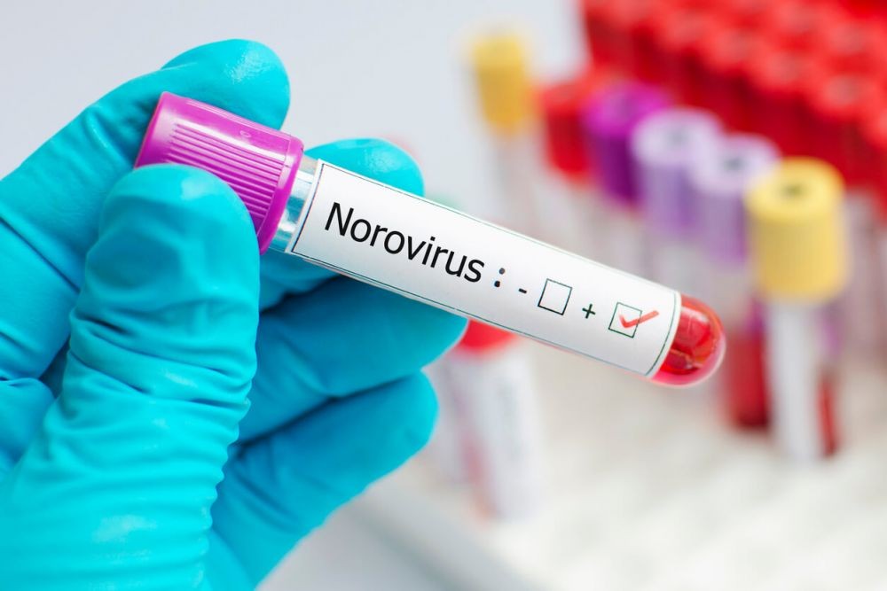 Mewabah di Tiongkok, 7 Fakta Norovirus yang Sebabkan Radang Perut