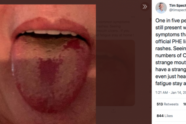 Gejala Baru Covid 19 Apa Itu Covid Tongue