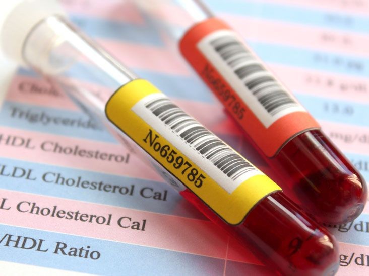 Penyebab, Bahaya, dan Cara Atasi Kolesterol Tinggi