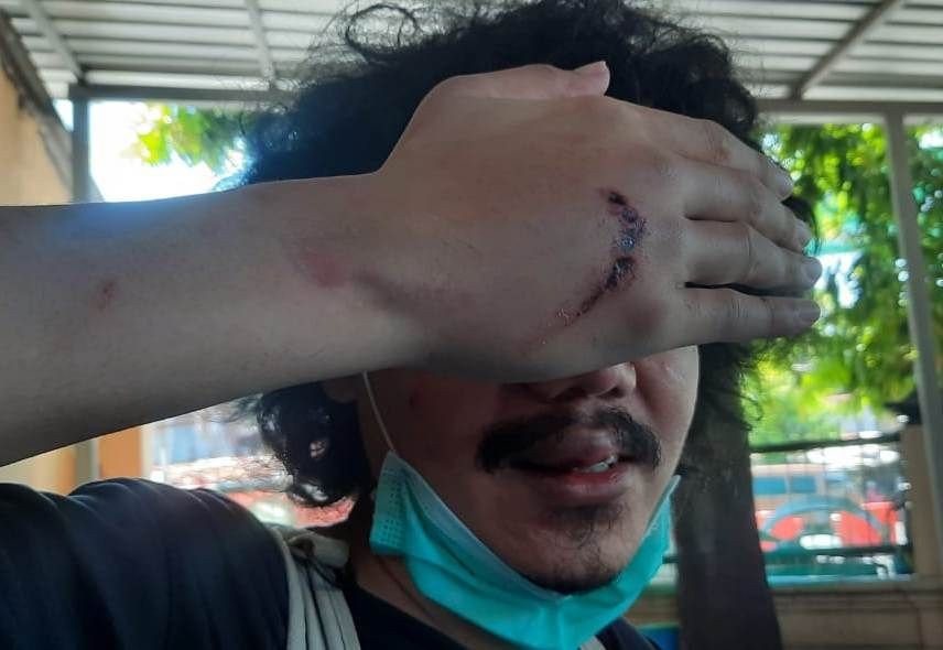 Jurnalis Surabaya Jadi Korban Pengeroyokan Orang Tak Dikenal