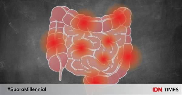 Penyakit Crohn: Penyebab, Gejala, Diagnosis, Dan Pengobatan