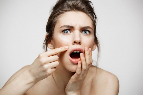 Beda Purging dan Breakout, Jerawat usai Coba Skincare Baru