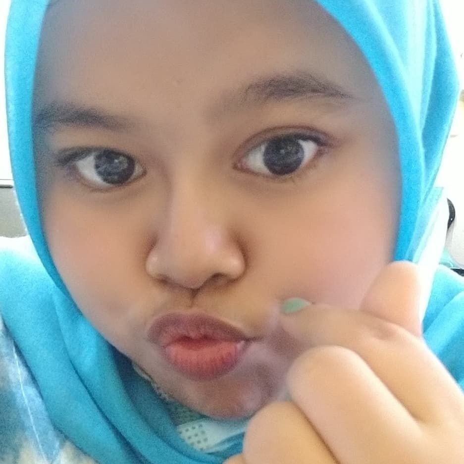 Pangling Gak? 10 Potret Kekeyi Sebelum dan Sesudah Filler Hidung
